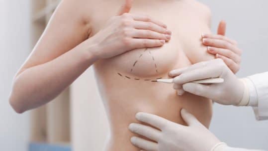 Sydney plastic surgeon mapping out breast surgery on patient