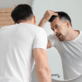 early signs of balding male pattern baldness symptoms early stage male pattern baldness signs of balding beginning male pattern baldness early stages of balding