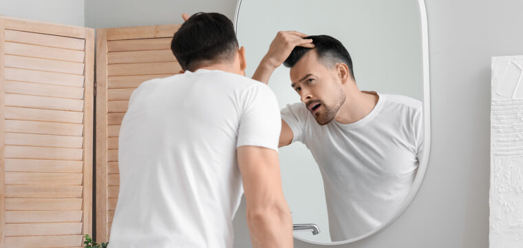 early signs of balding male pattern baldness symptoms early stage male pattern baldness signs of balding beginning male pattern baldness early stages of balding
