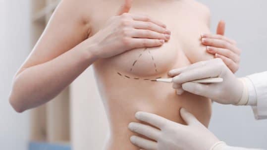 The Final Touch: What to Expect from Nipple Reconstruction Surgery