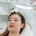 Postpartum hair loss Hair loss after pregnancy Hair shedding postpartum Hormonal hair loss Hair thinning after childbirth Female hair loss Hair growth after pregnancy